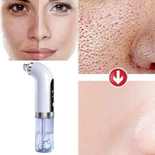 Load image into Gallery viewer, Blackhead Remover Pore Vacuum Cleaner Upgraded Blackhead Vacuum Rechargeable Face Vacuum Comedone Extractor-marginseye
